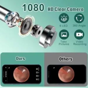 Earwax Removal Tool Kit with HD Camera Wifi Connection & 6 LED Lights Endoscope Tool Ear Cleaner for iOS & Android + 11 Silicone Tips Free- Black ( black, Standard )